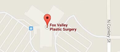 Fox Valley Plastic Surgery  Body Lift Surgery (Lipectomy)