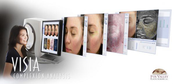 VISIA® Complexion Analysis