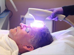 Patient receiving Levulan® Photodynamic Therapy