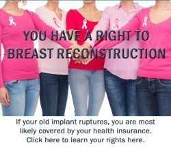 You have a right to breast reconstruction.