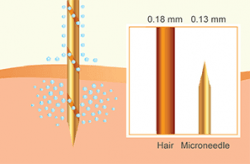 Aquagold needle thickness