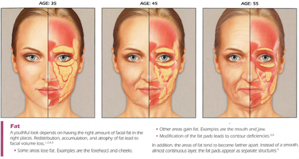 Fat distribution in aging