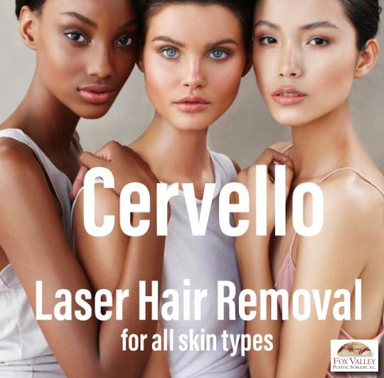 3 women for laser hair removal