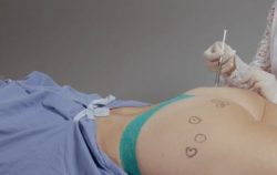 Injection into buttock