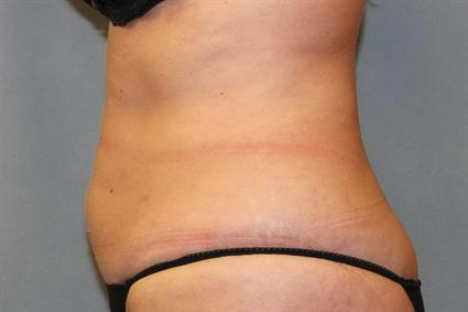 After 7 wks.