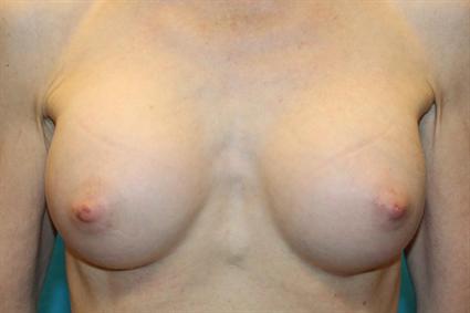 After Photo