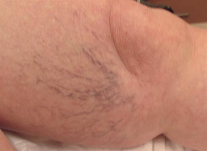 Before Photo