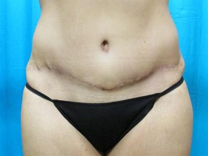 After 8 mos.