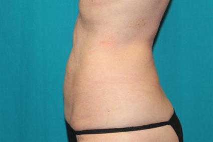 After 5 mos.