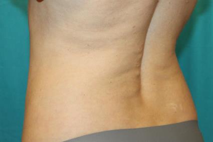After 6 wks.