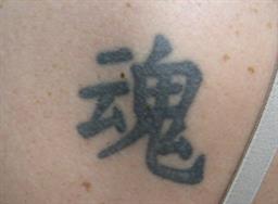 Image of tattoo before laser tattoo removal