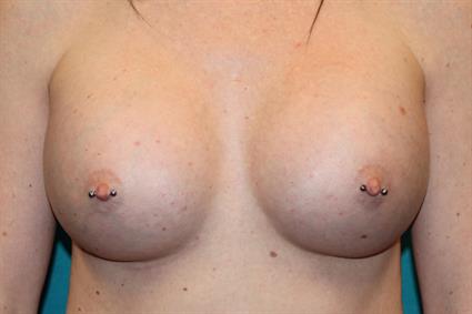 After Photo