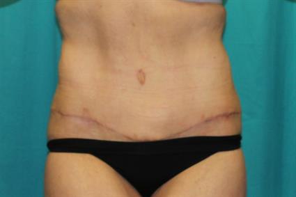 After 10 weeks