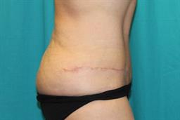 After 10 weeks