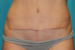 After 6 weeks