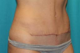 After 6 weeks