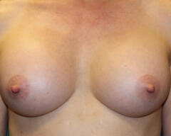 Breasts Front after