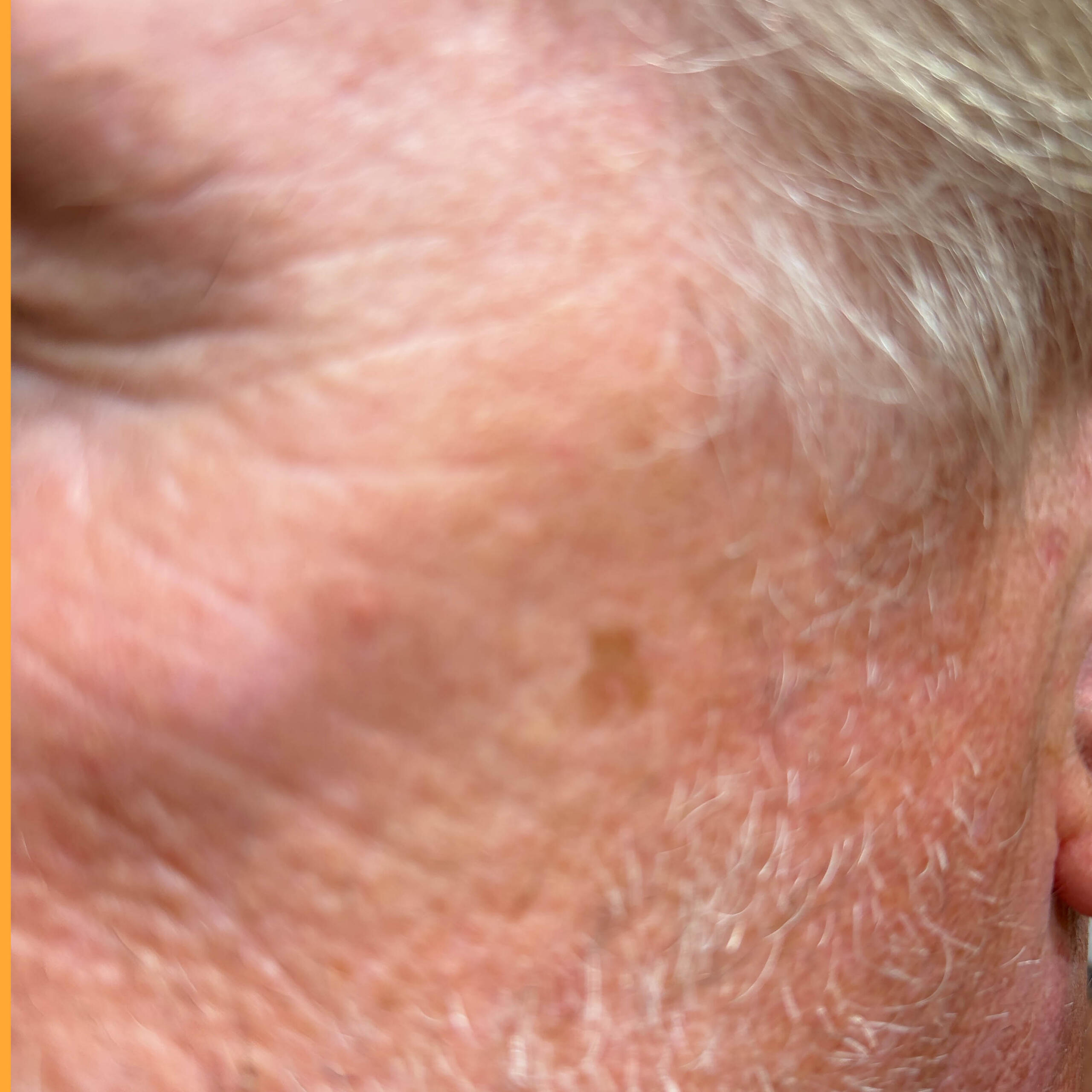 Left Cheek before case 414